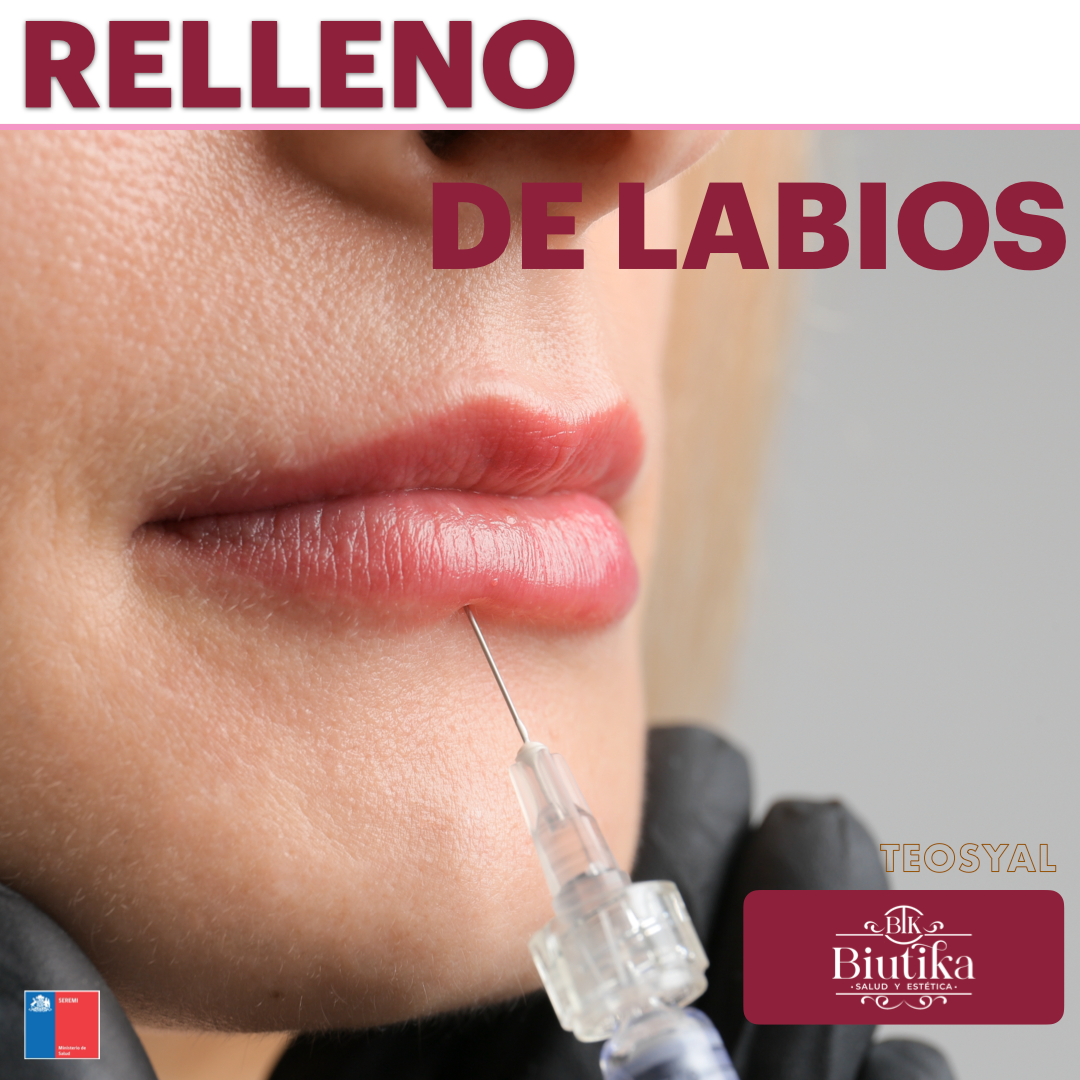 Relleno de labios