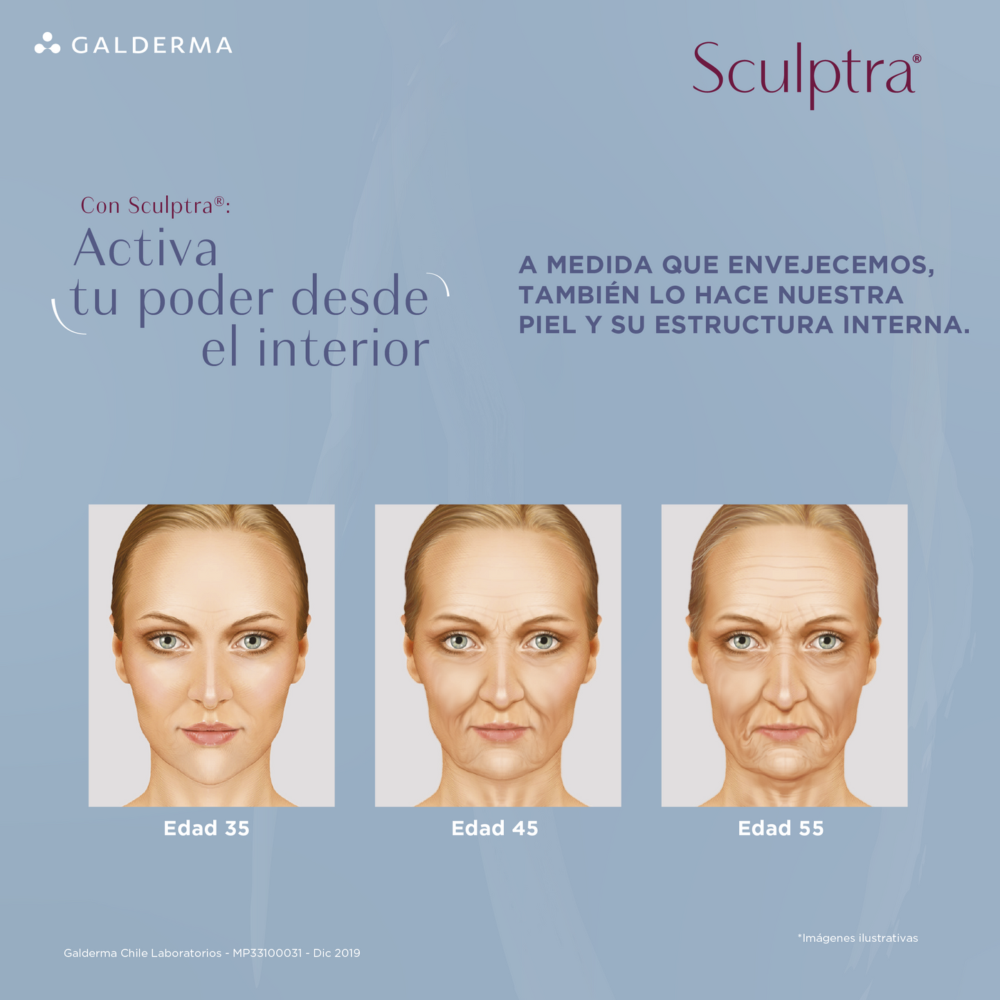 Sculptra