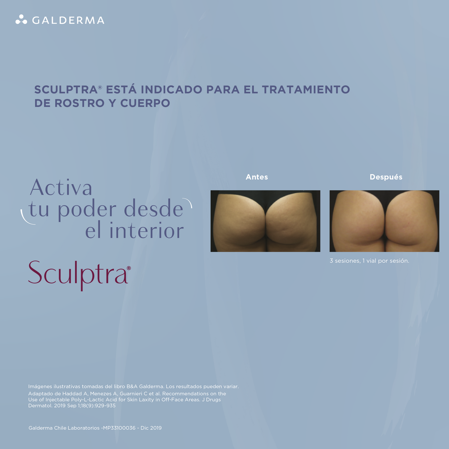Sculptra